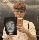 Mikhail with an X-ray of his own skull, pixelated